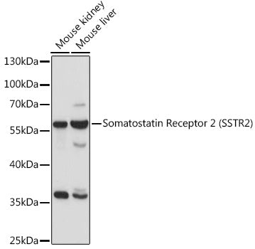 Somatostatin Receptor 2 (SSTR2) Rabbit pAb