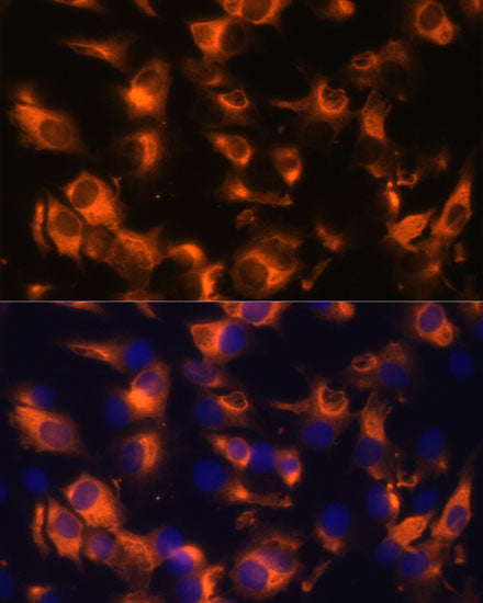 Somatostatin Receptor 2 (SSTR2) Rabbit pAb