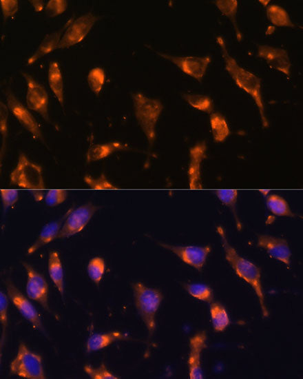 Somatostatin Receptor 2 (SSTR2) Rabbit pAb