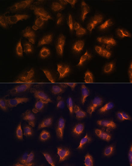 Somatostatin Receptor 2 (SSTR2) Rabbit pAb
