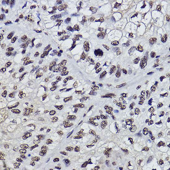 PDCD7 Rabbit mAb