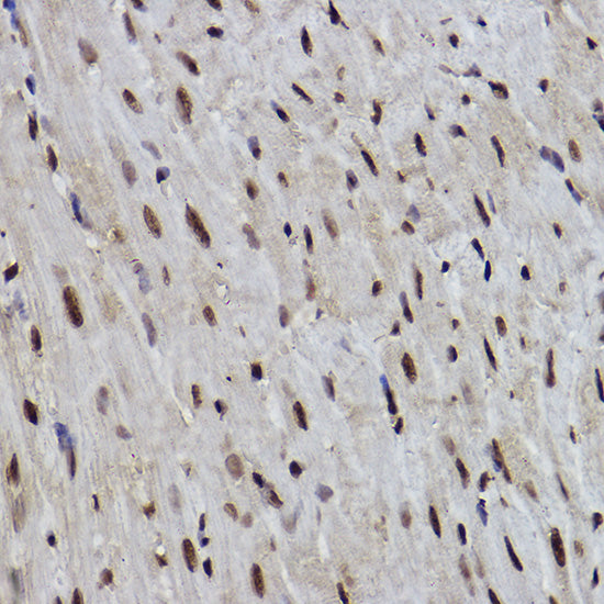 PDCD7 Rabbit mAb