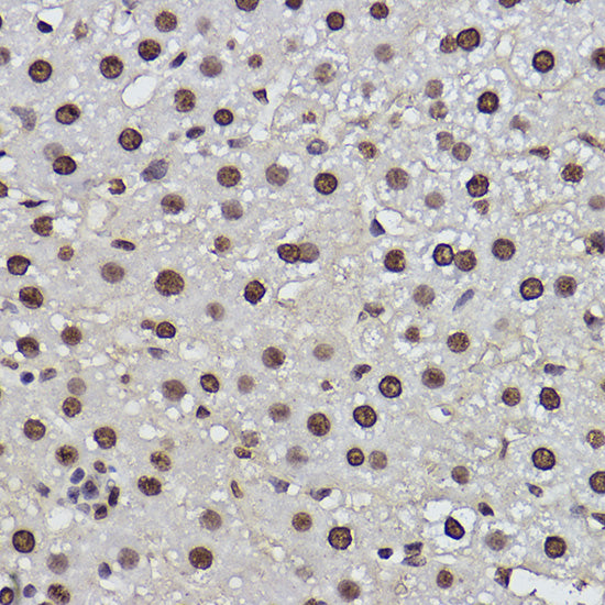 PDCD7 Rabbit mAb