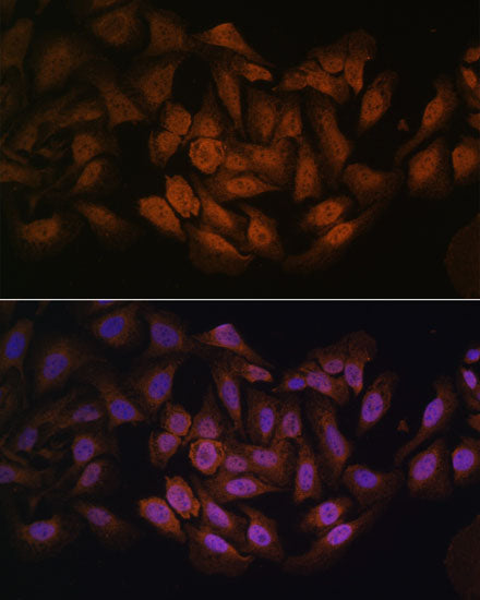 CNBP Rabbit pAb