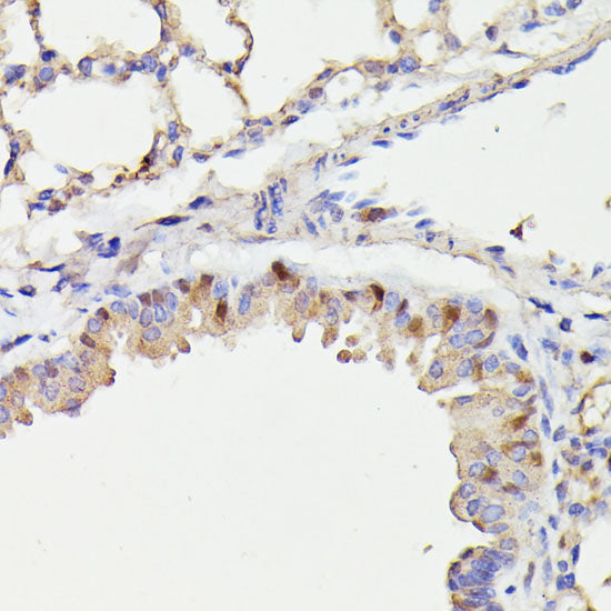 CDC23 Rabbit pAb