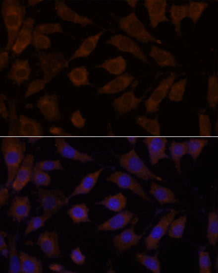 OXSR1 Rabbit pAb