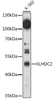 KLHDC2 Rabbit pAb