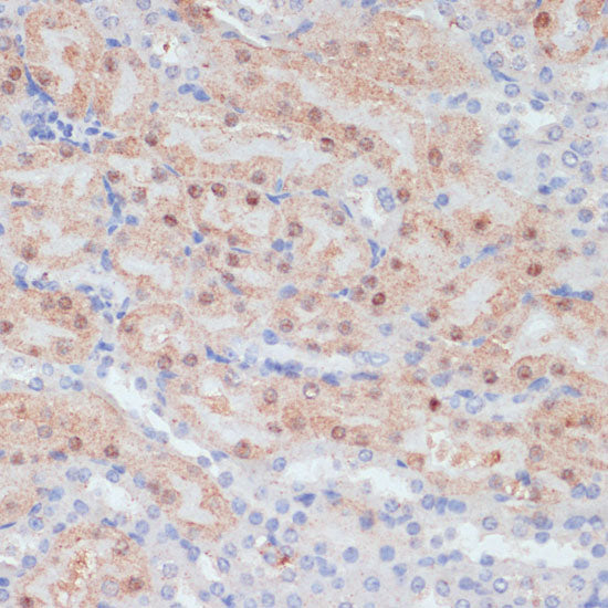 CLDN17 Rabbit pAb