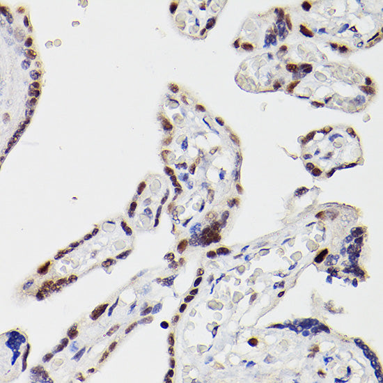 HDAC9 Rabbit pAb
