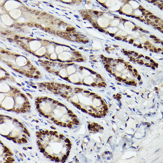 HDAC9 Rabbit pAb