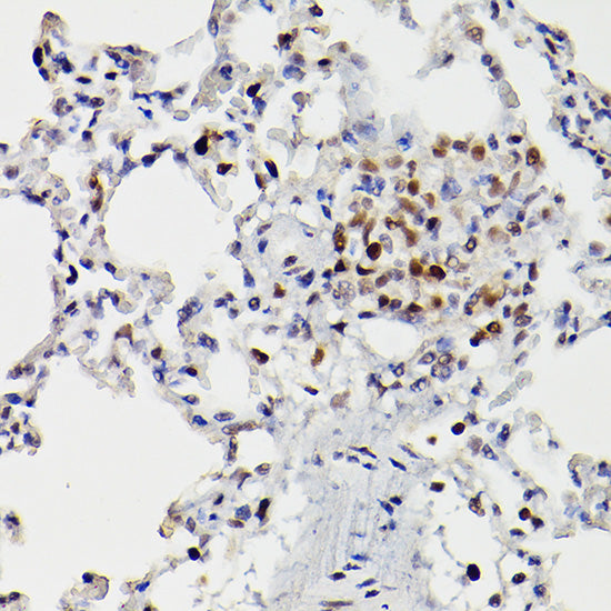 HDAC9 Rabbit pAb