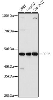 PRR5 Rabbit pAb
