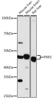 PRR5 Rabbit pAb