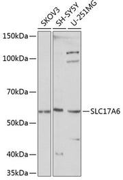 SLC17A6 Rabbit pAb