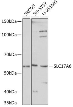 SLC17A6 Rabbit pAb