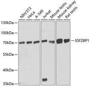 IGF2BP1/IMP1 Rabbit pAb