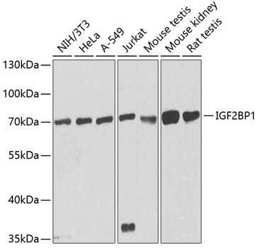 IGF2BP1/IMP1 Rabbit pAb