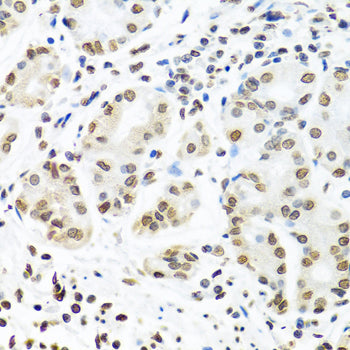 IGF2BP1/IMP1 Rabbit pAb