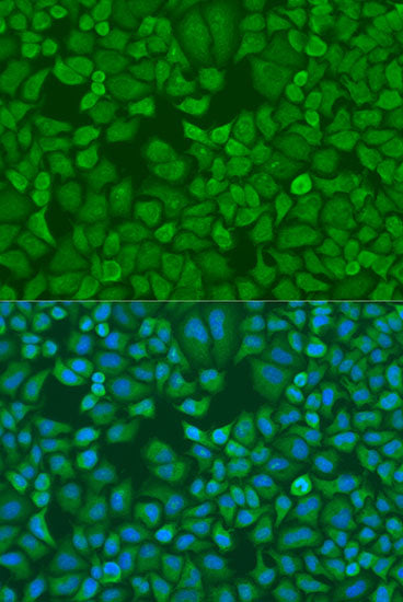 IGF2BP1/IMP1 Rabbit pAb