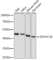 ZDHHC18 Rabbit pAb