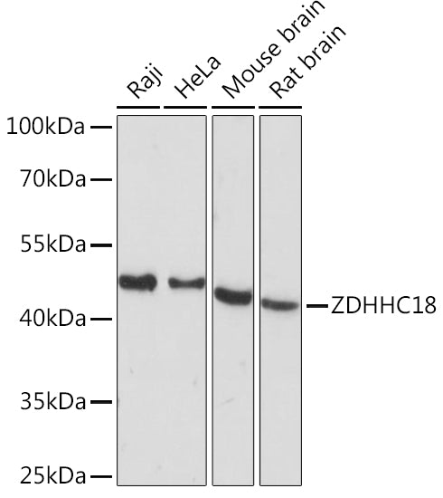 ZDHHC18 Rabbit pAb