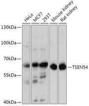 TSEN54 Rabbit pAb