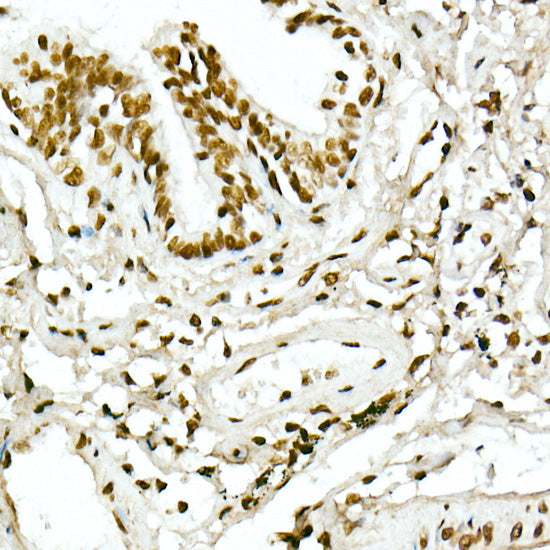 Acetyl-Histone H4-K5 Rabbit pAb