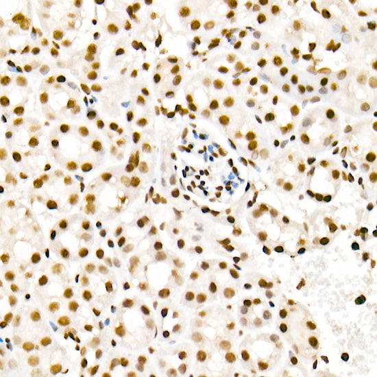 Acetyl-Histone H4-K5 Rabbit pAb