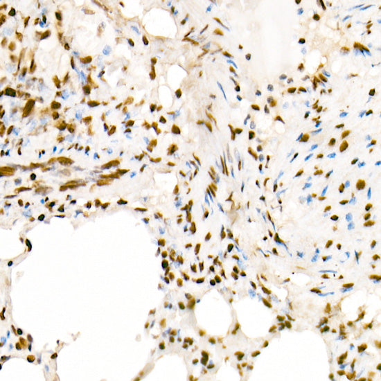 Acetyl-Histone H4-K5 Rabbit pAb