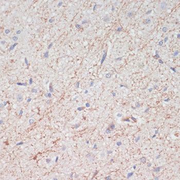 Dopamine Transporter/SLC6A3 Rabbit pAb