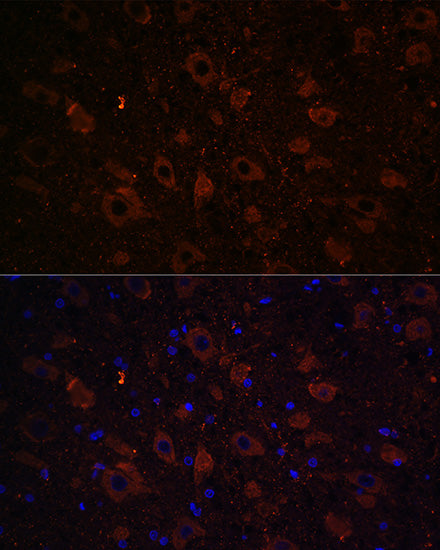Dopamine Transporter/SLC6A3 Rabbit pAb