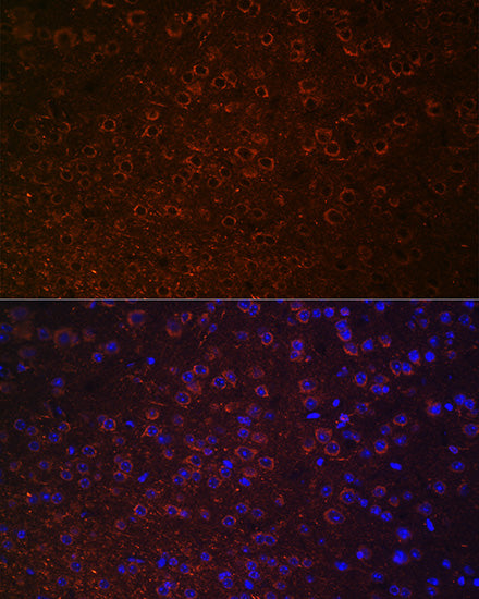 Dopamine Transporter/SLC6A3 Rabbit pAb