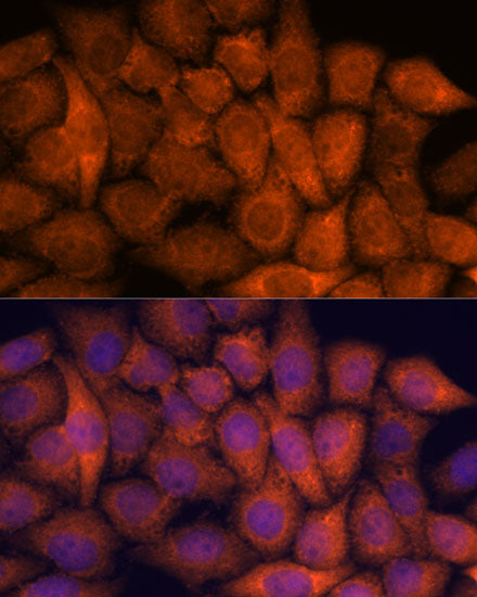 RPAP3 Rabbit pAb
