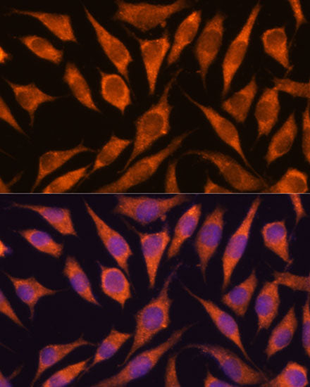 RPAP3 Rabbit pAb