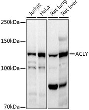 ACLY Rabbit pAb