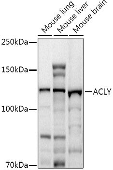ACLY Rabbit pAb