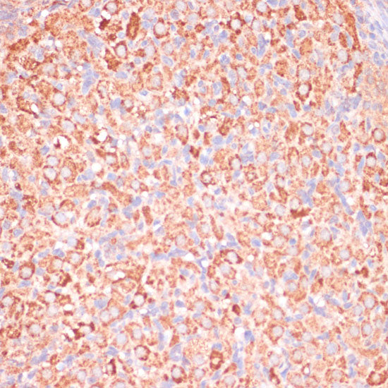 ATP5C1 Rabbit pAb