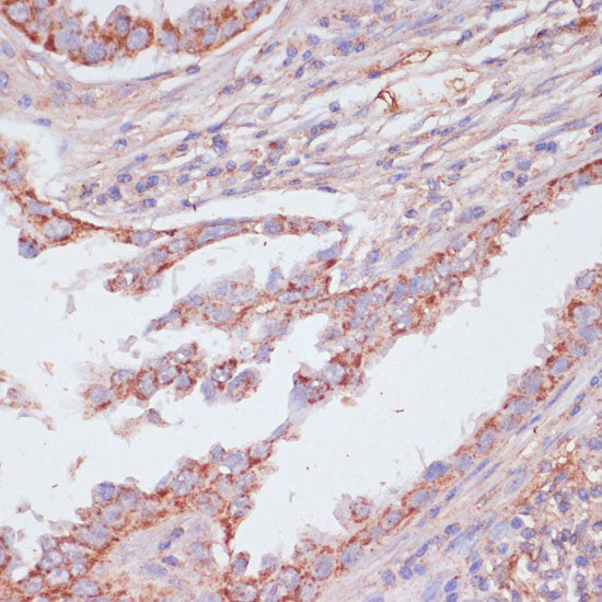 ATP5C1 Rabbit pAb