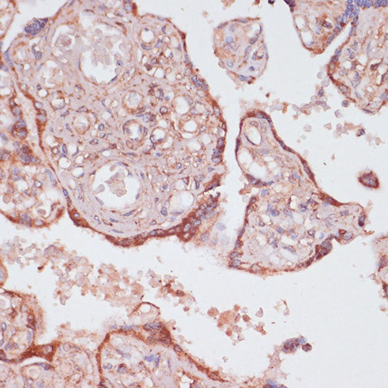 ATP5C1 Rabbit pAb