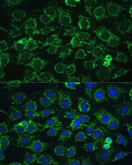 ATP5C1 Rabbit pAb