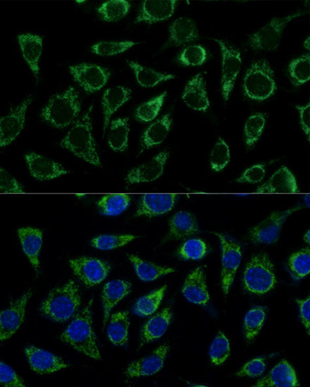 ATP5C1 Rabbit pAb