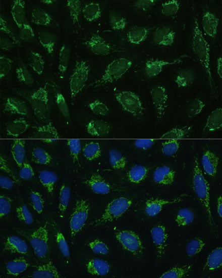 ATP5C1 Rabbit pAb