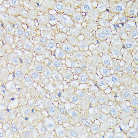 CTNNA2 Rabbit pAb