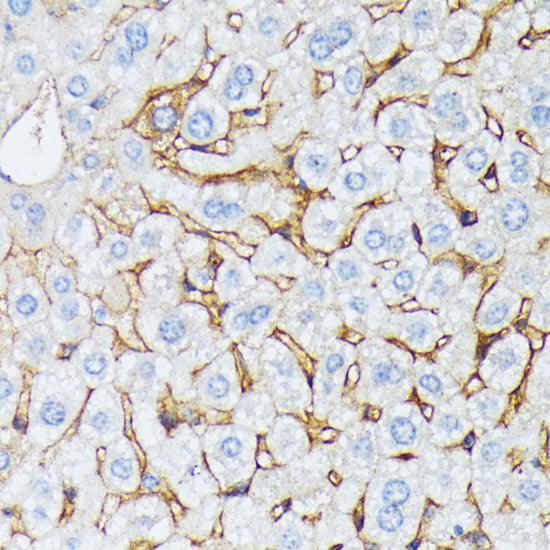 CTNNA2 Rabbit pAb