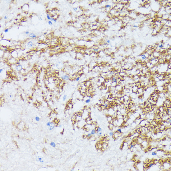 CTNNA2 Rabbit pAb