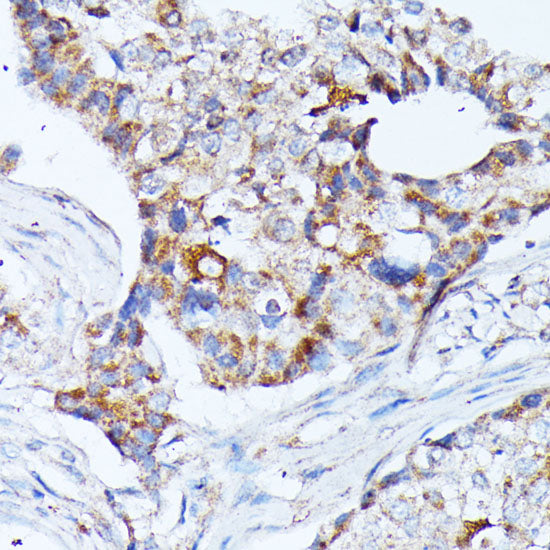 KCNJ15 Rabbit pAb