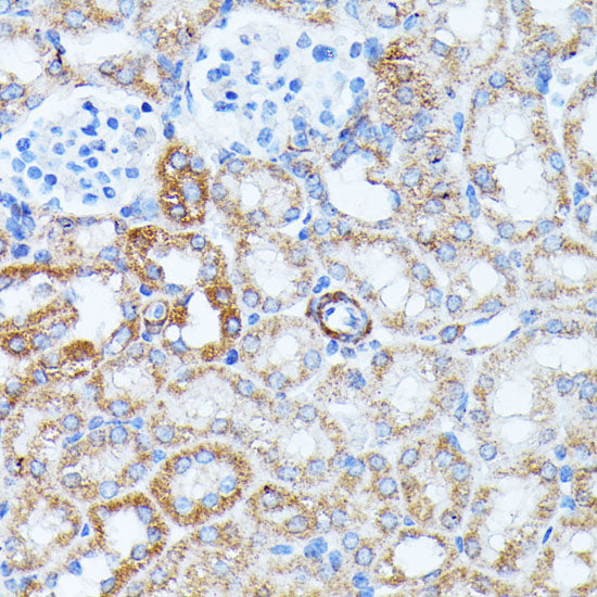 KCNJ15 Rabbit pAb
