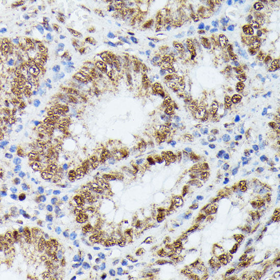 KIF22 Rabbit pAb