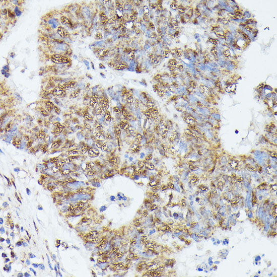 KIF22 Rabbit pAb