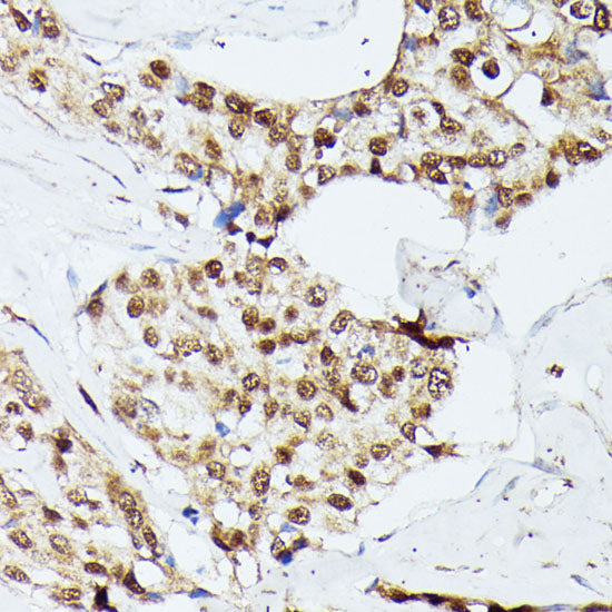 KIF22 Rabbit pAb
